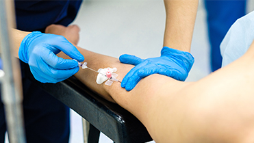 Training with a peripheral intravenous catheter care algorithm to affect phlebitis and infiltration incidence: An interventional, before and after study.